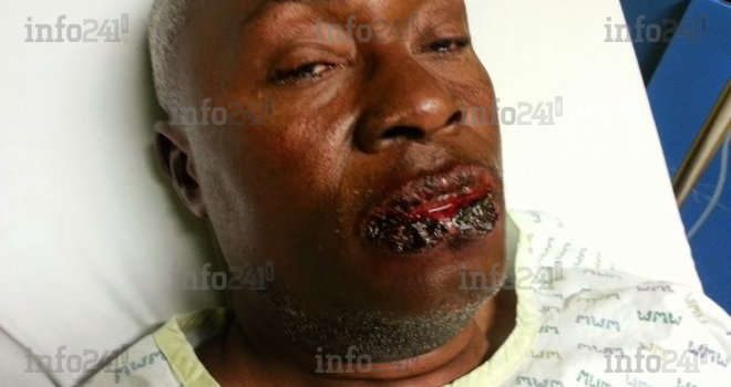 Les images de &laquo;&nbsp;l’empoisonnement&nbsp;&raquo; de sieur Iwangou dateraient de l’année dernière