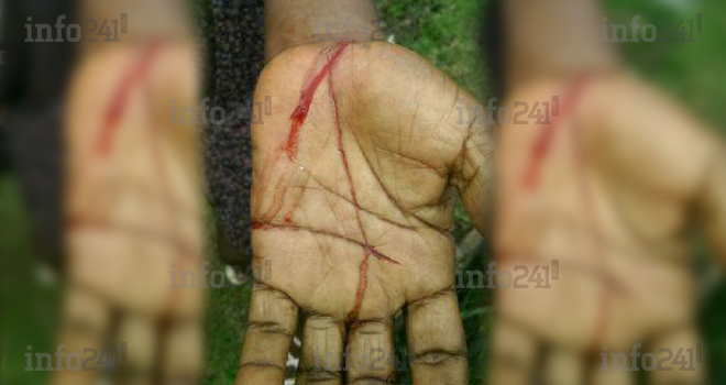 Une dame de ménage blessée à la machette par l’épouse de son ex-employeur