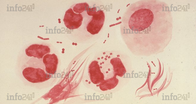 La bactérie responsable de la gonorrhée de plus en plus résistante aux antibiotiques