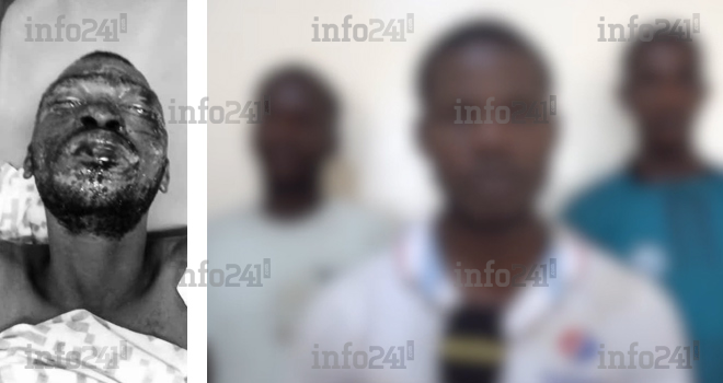 Port-Gentil&nbsp;: 3 &laquo;&nbsp;initiés&nbsp;&raquo; écroués après avoir brulé leur victime lors d’une cérémonie traditionnelle