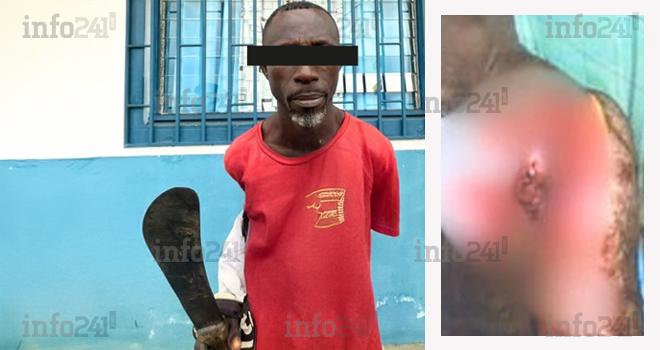 Nkoltang : Un ghanéen cocufié tente de trancher le cou de son rival gabonais à la machette