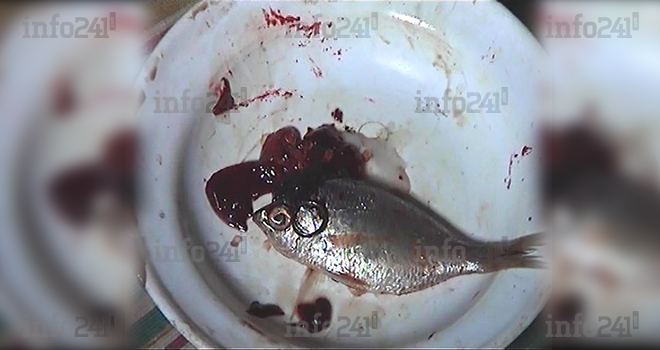 Une dorade vivait depuis deux ans dans le ventre d’une trentenaire à Libreville