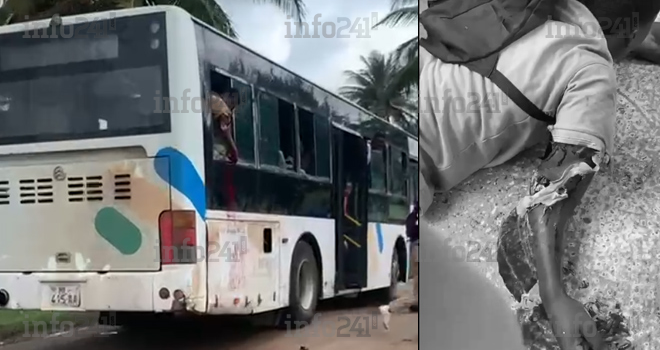 Libreville : Un élève du lycée technique se coupe le bras droit à bord d’un bus scolaire